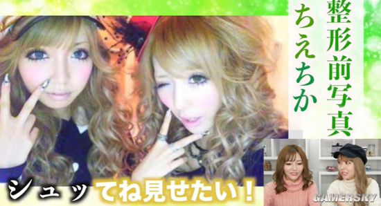 号称日本最美“整容双胞胎” 公开整容前照片自嘲黑历史