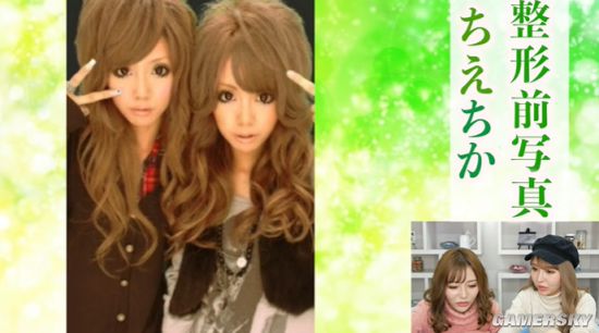 号称日本最美“整容双胞胎” 公开整容前照片自嘲黑历史