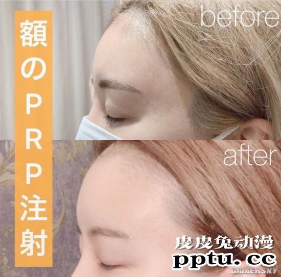 号称日本最美“整容双胞胎” 公开整容前照片自嘲黑历史