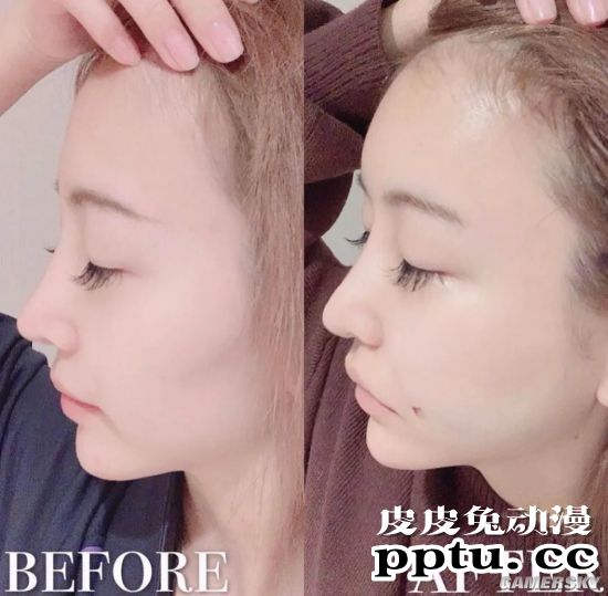 号称日本最美“整容双胞胎” 公开整容前照片自嘲黑历史